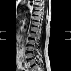 MRI_MobiView_Sag_T2W_TSE_403